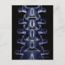 Search for vertebrae postcards Medical
