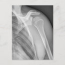 Search for human bones postcards Vintage