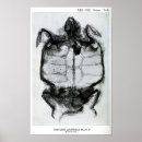 Search for x ray bones posters Medical