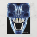 Search for x rays postcards Vertical
