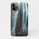 Search for skeleton bones iphone cases Funny