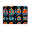 Search for mri magnets Brain
