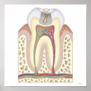 Search for tooth posters Medical