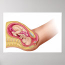Search for foetus posters Childbirth