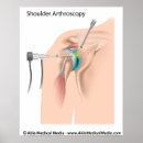 Search for procedure art Surgical