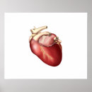 Search for artery Pulmonary artery