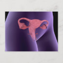 Search for gonad postcards Genitourinary system