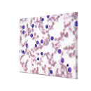 Search for research posters canvas prints medical