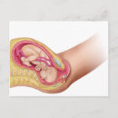 Search for childbirth postcards Amniotic sac