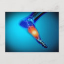 Search for human limb postcards Joint