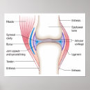 Search for joint posters Chart
