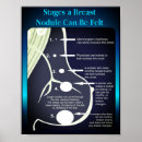 Search for breast cancer posters Mammography