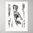 Search for wrist posters Medical