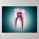 Search for dental posters Illustration