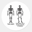 Search for ehlers danlos syndrome Pots
