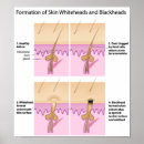 Search for skin care posters Dermatology