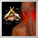Search for pain posters Medicine