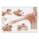 Search for inflammation Illness