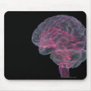Search for human brain mouse mats Part