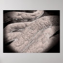 Search for pathological posters Healthcare