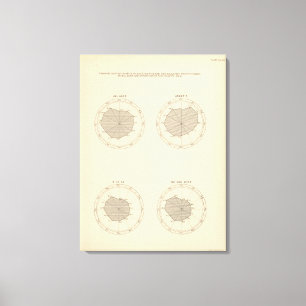 113 Deaths by month 1900 Canvas Print