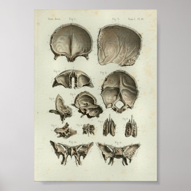 1844 Vintage Anatomy Print Skull Bones (Front)