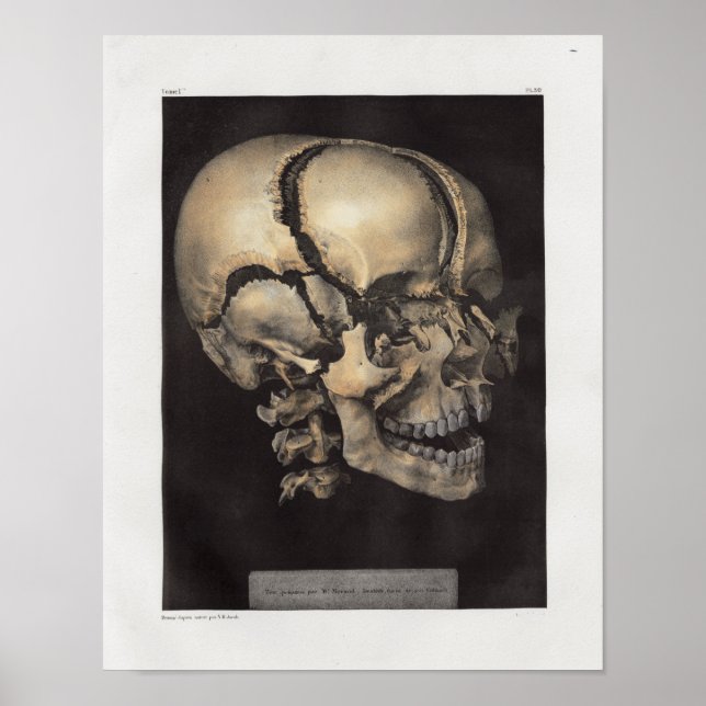 1867 Human Skull Vintage Anatomy Print (Front)
