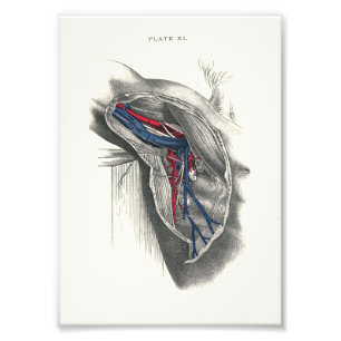 1895 Human Anatomy Print Arm Axilla