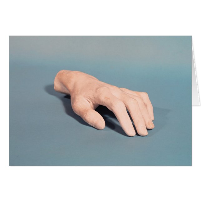 A cast of the hand of Frederic Chopin (Front Horizontal)