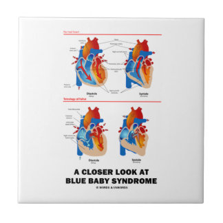 A Closer Look At Blue Baby Syndrome Heart Anatomy Tile