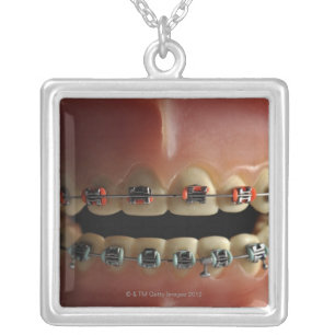 A dental model and Teeth braces Silver Plated Necklace