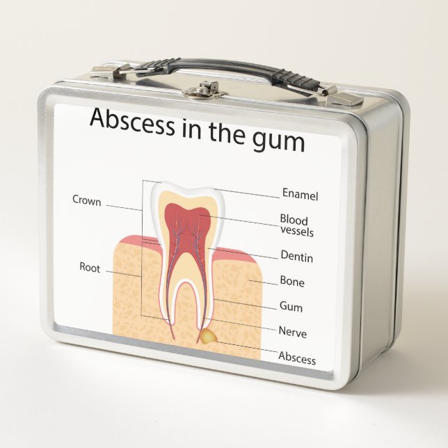 Abscess in the gum metal lunch box (Front)