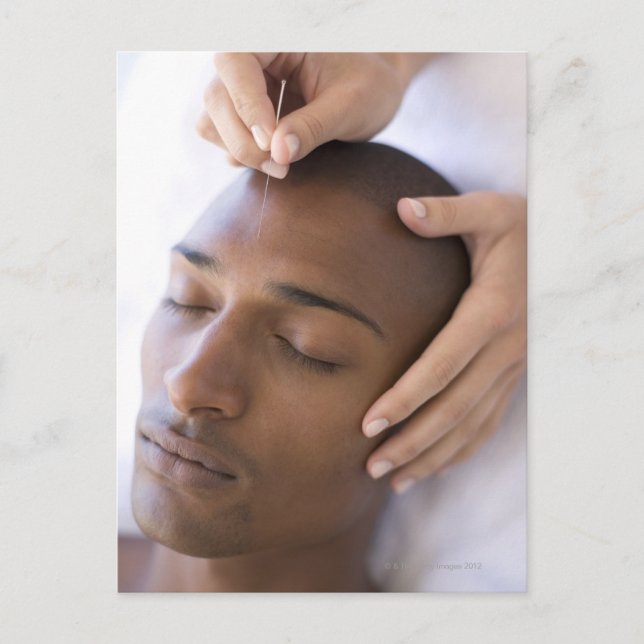 Acupuncture. Acupuncturist inserting a needle Postcard (Front)