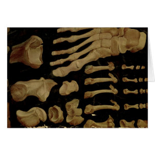 Anatomical drawing of the bones of the foot