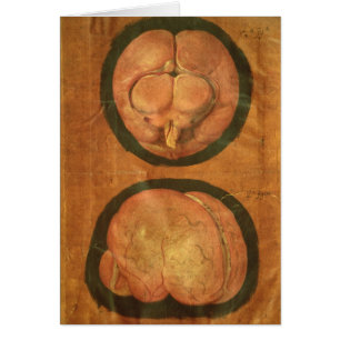 Anatomical drawing of the human brain