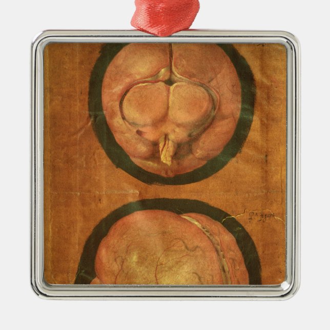 Anatomical drawing of the human brain metal tree decoration (Front)