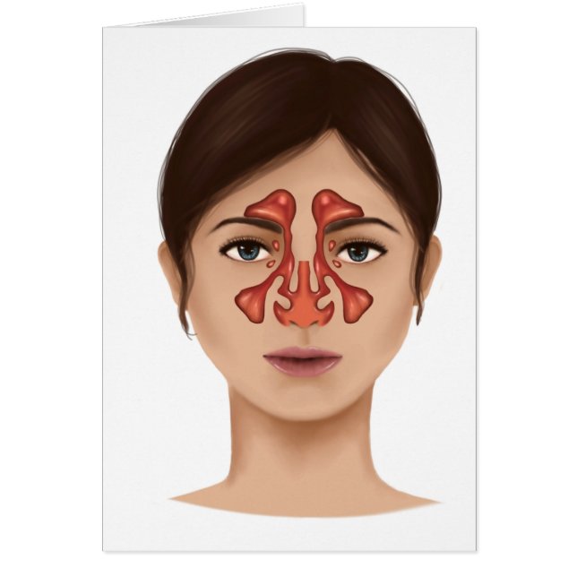Anatomy Of Nasal Sinuses (Front)
