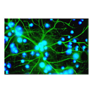 Astrocyte Are Star Shaped Glial Cells in the Brain Photo Print