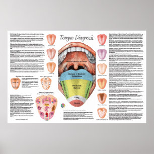 Ayurvedic Tongue Diagnosis Map  Poster