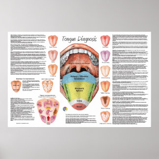 Ayurvedic Tongue Diagnosis Map  Poster