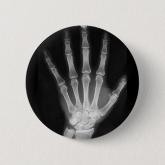 B&W X-ray Skeleton Hand 6 Cm Round Badge