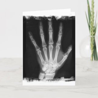 B&W X-ray Skeleton Hand Card
