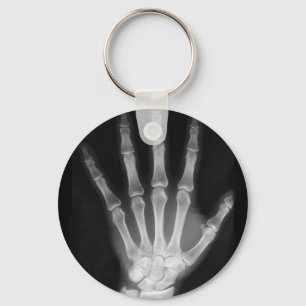 B&W X-ray Skeleton Hand Key Ring