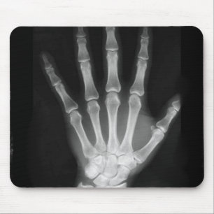 B&W X-ray Skeleton Hand Mouse Mat