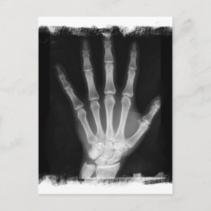 B&W X-ray Skeleton Hand Postcard