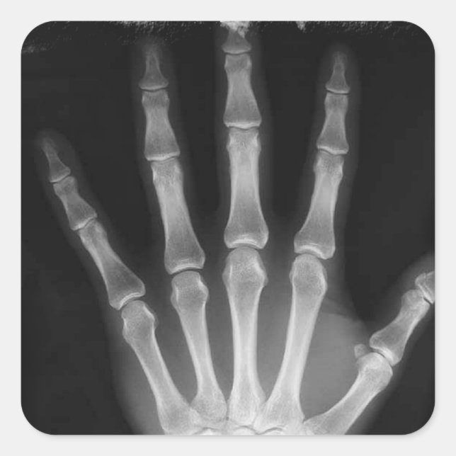 B&W X-ray Skeleton Hand Square Sticker (Front)