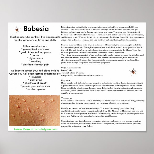 Babesia Symptoms and Transmission Poster (Front)