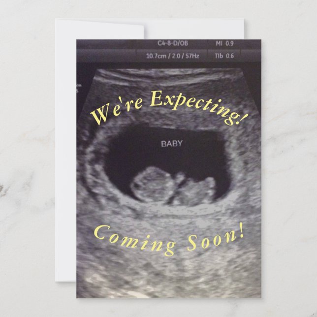 Baby Announcement (Front)