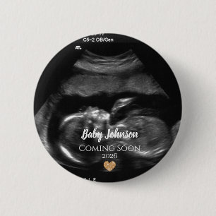 Baby Coming Soon Ultrasound Gold heart  6 Cm Round Badge