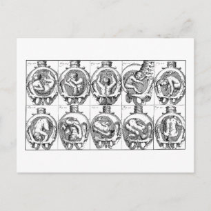 Baby in womb Vintage Midwife anatomy illustration  Postcard